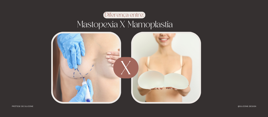 Silicone Design (Imagem para blog) (1140 × 500 px)