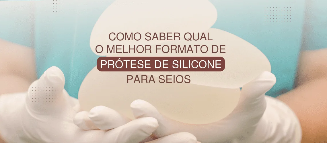 Silicone Design (Imagem para blog) (1140 × 500 px) (2)